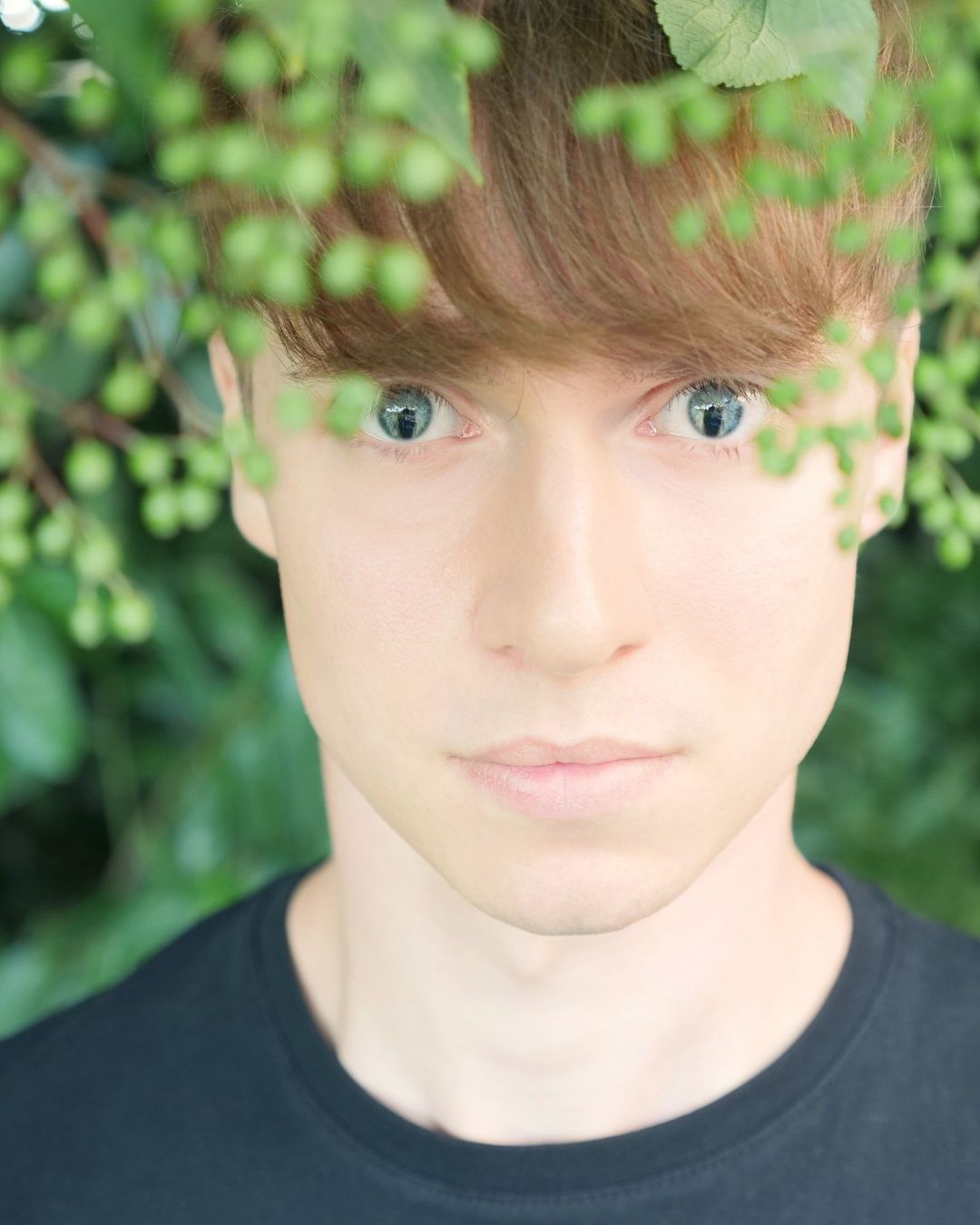 Вот как выглядят люди с генетическим дефектом глаз, который делает взгляд "змеиным"