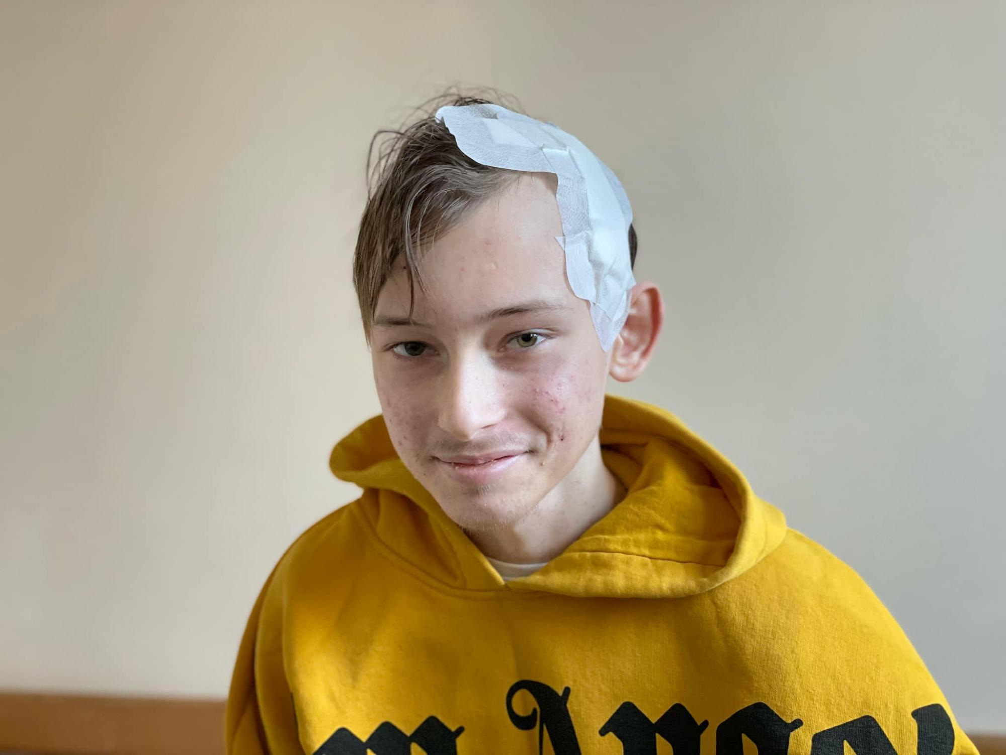 Ребенок говорил во время вмешательства: в Украине впервые провели операцию на мозге с пробуждением