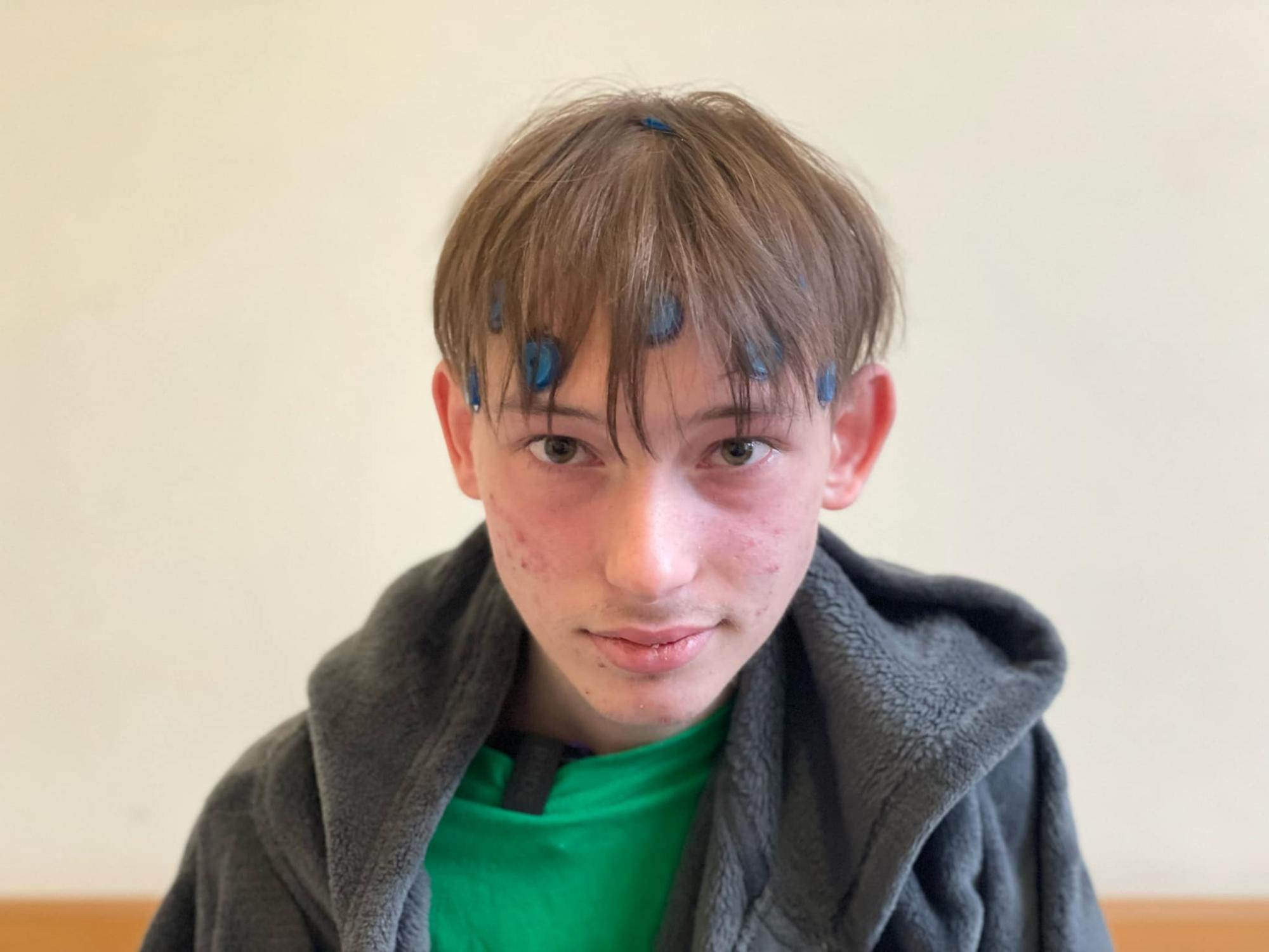 Ребенок говорил во время вмешательства: в Украине впервые провели операцию на мозге с пробуждением