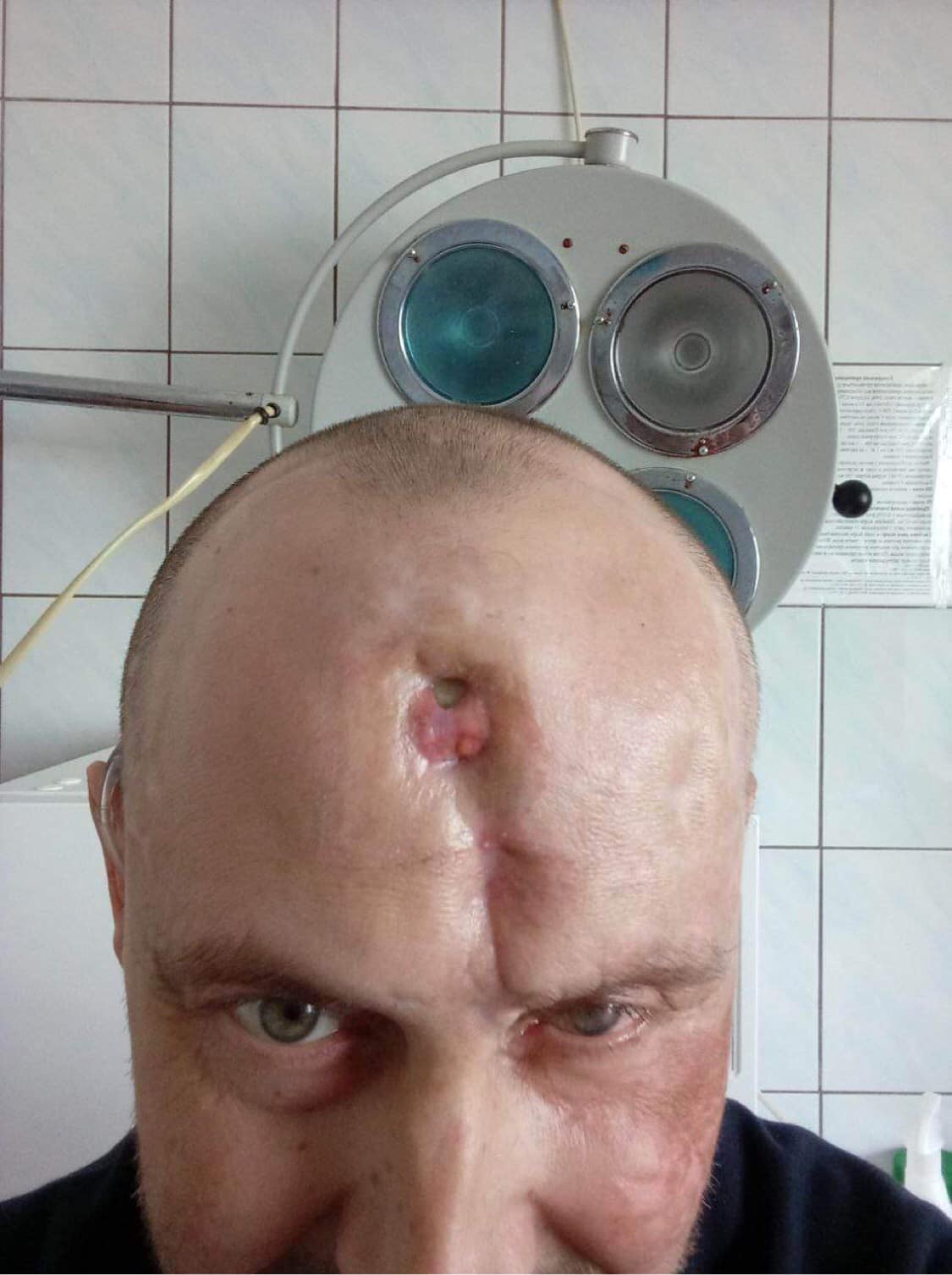 У Полтаві водій автобуса не пустив пораненого військового на сидяче місце: розгорається скандал