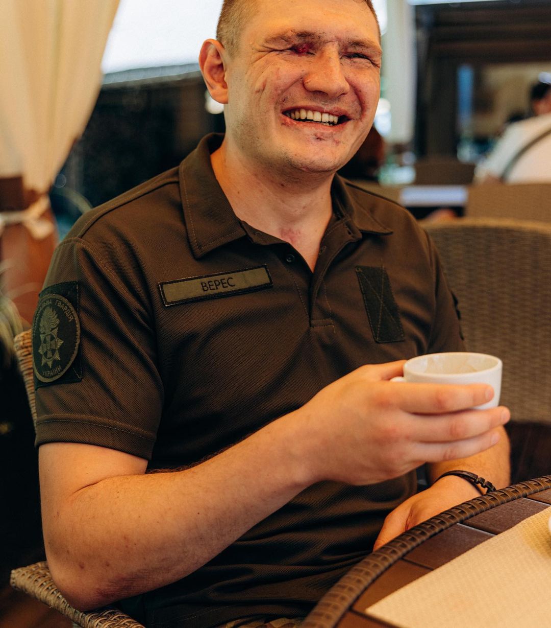 "Антитіла" потрапили в гучний скандал з незрячим воїном ЗСУ: всі деталі