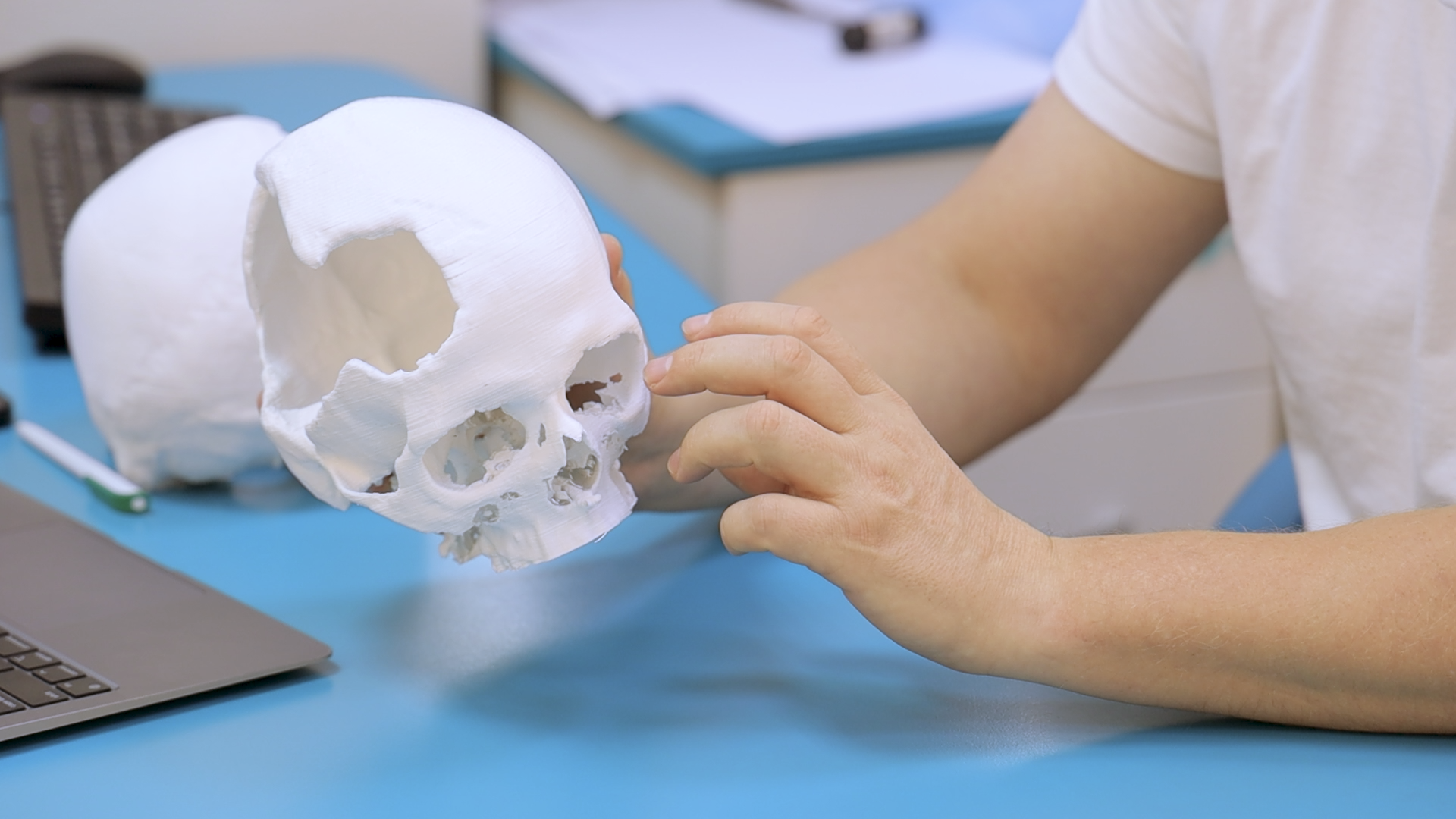 "Боліти буде ще довго". Як хірурги рятують життя військових після поранень на фронті