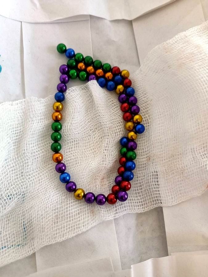 На Волыни двое детей попали на хирургический стол из-за игрушки, оказавшейся в мочевом пузыре