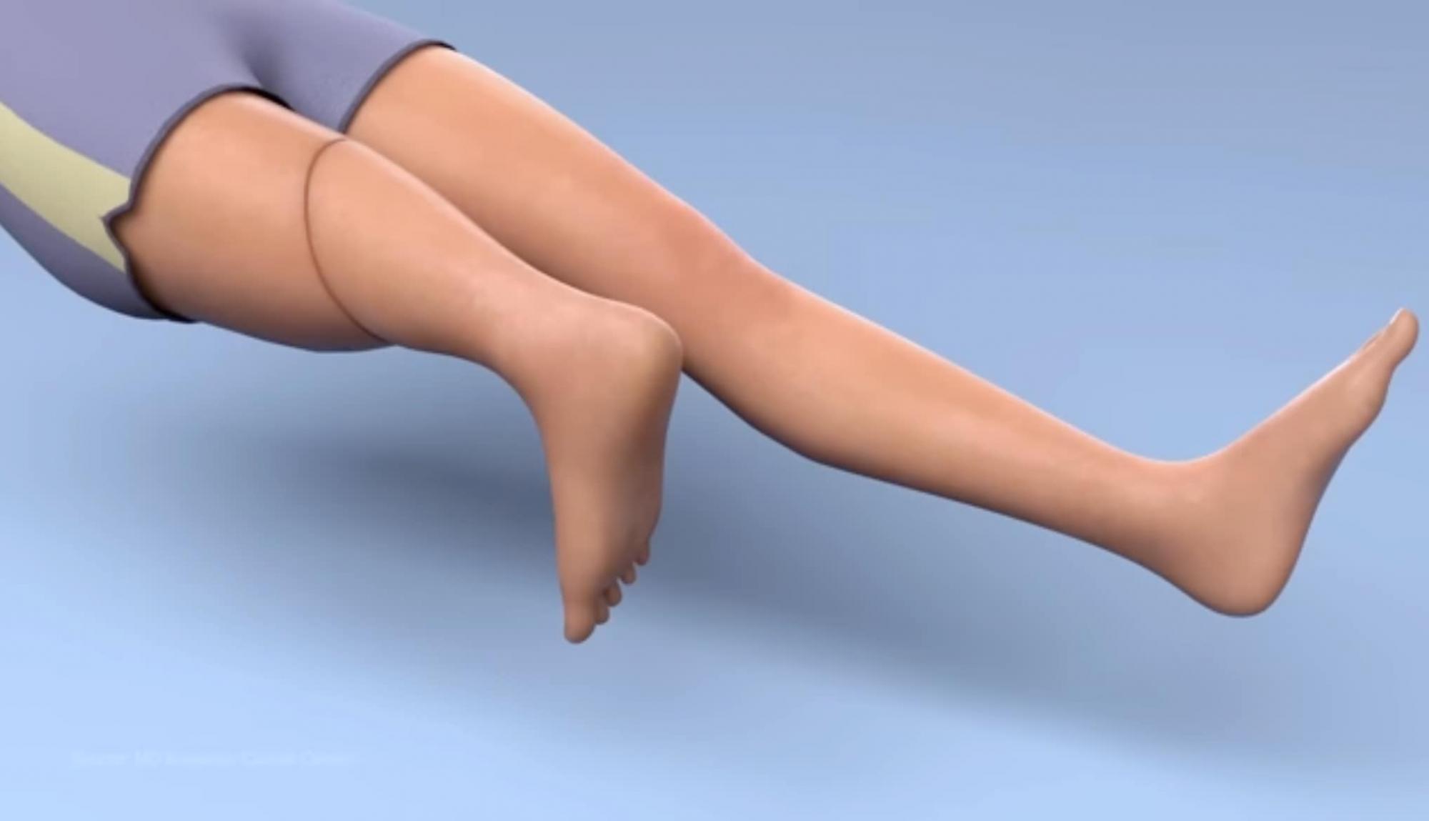 Лише це могло врятувати дівчину з раком: в Україні лікарі провели ризиковану операцію