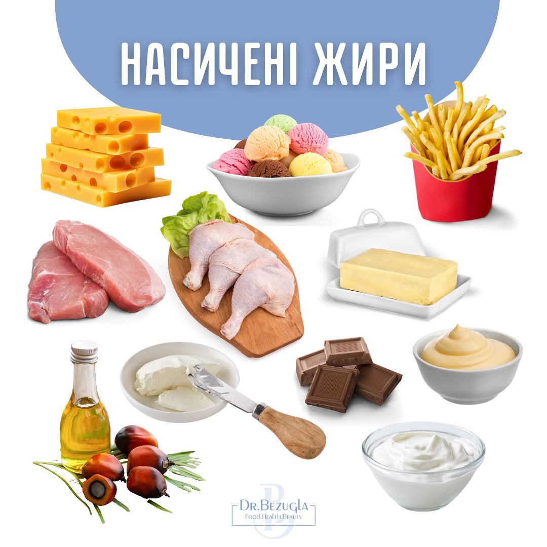 У яких продуктах ховаються насичені жири та скільки їх можна їсти на добу