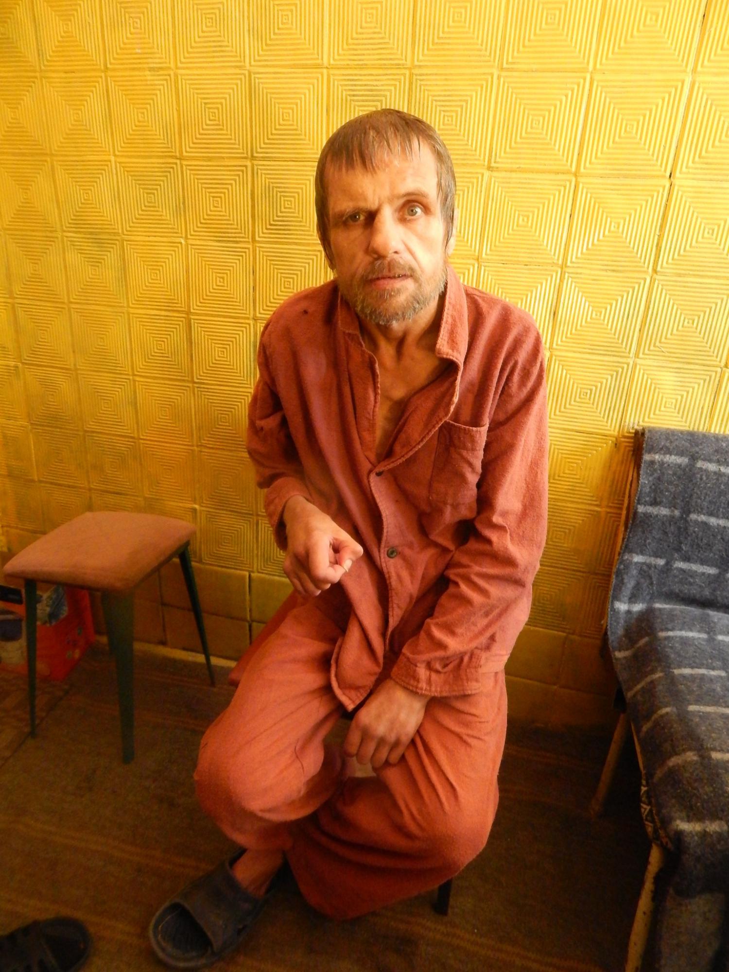 Украинец с вмятиной в голове, которого лечили от бронхита, умер в больнице: ужасные детали (фото)