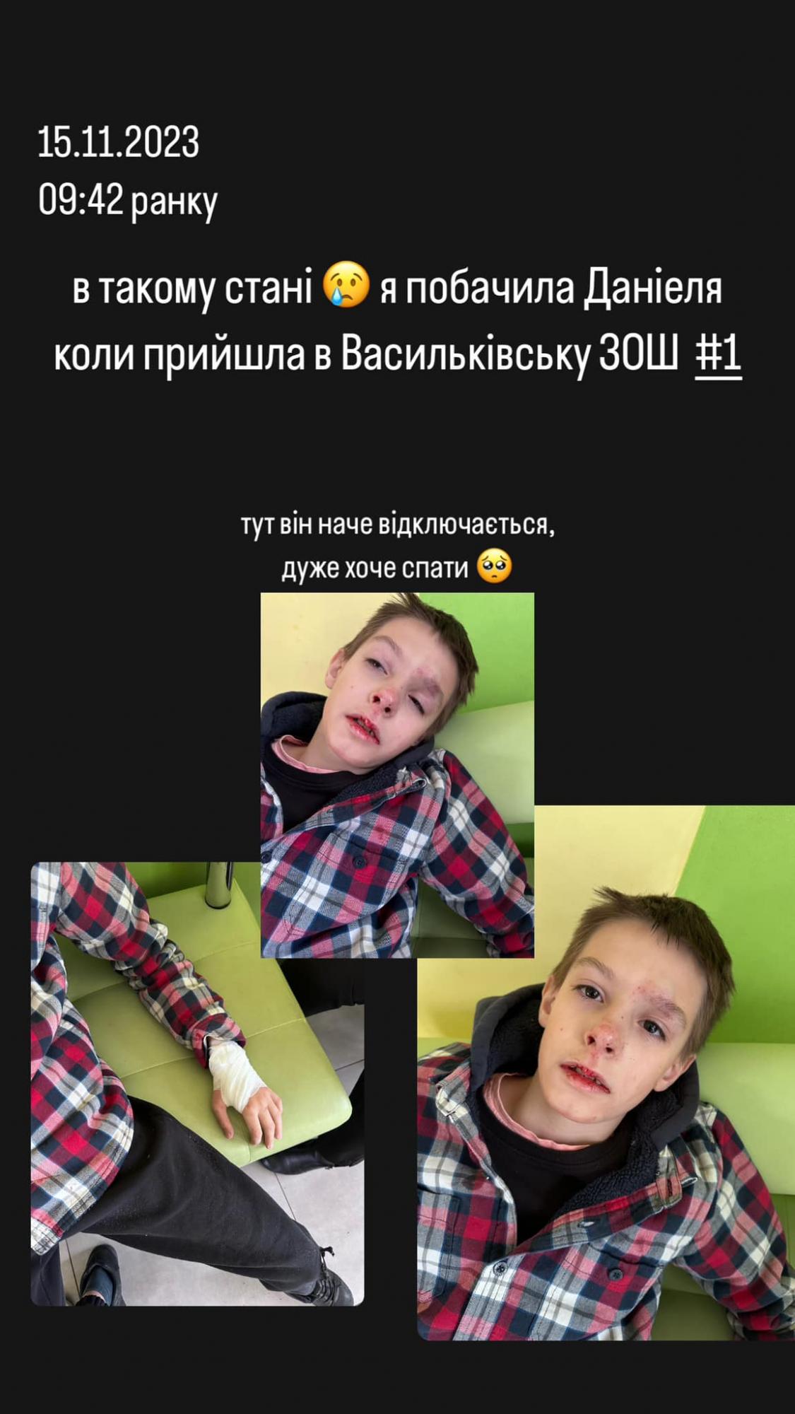 В школі під Києвом дитину скинули з висоти, а директор "умиває руки": деталі скандалу та відео