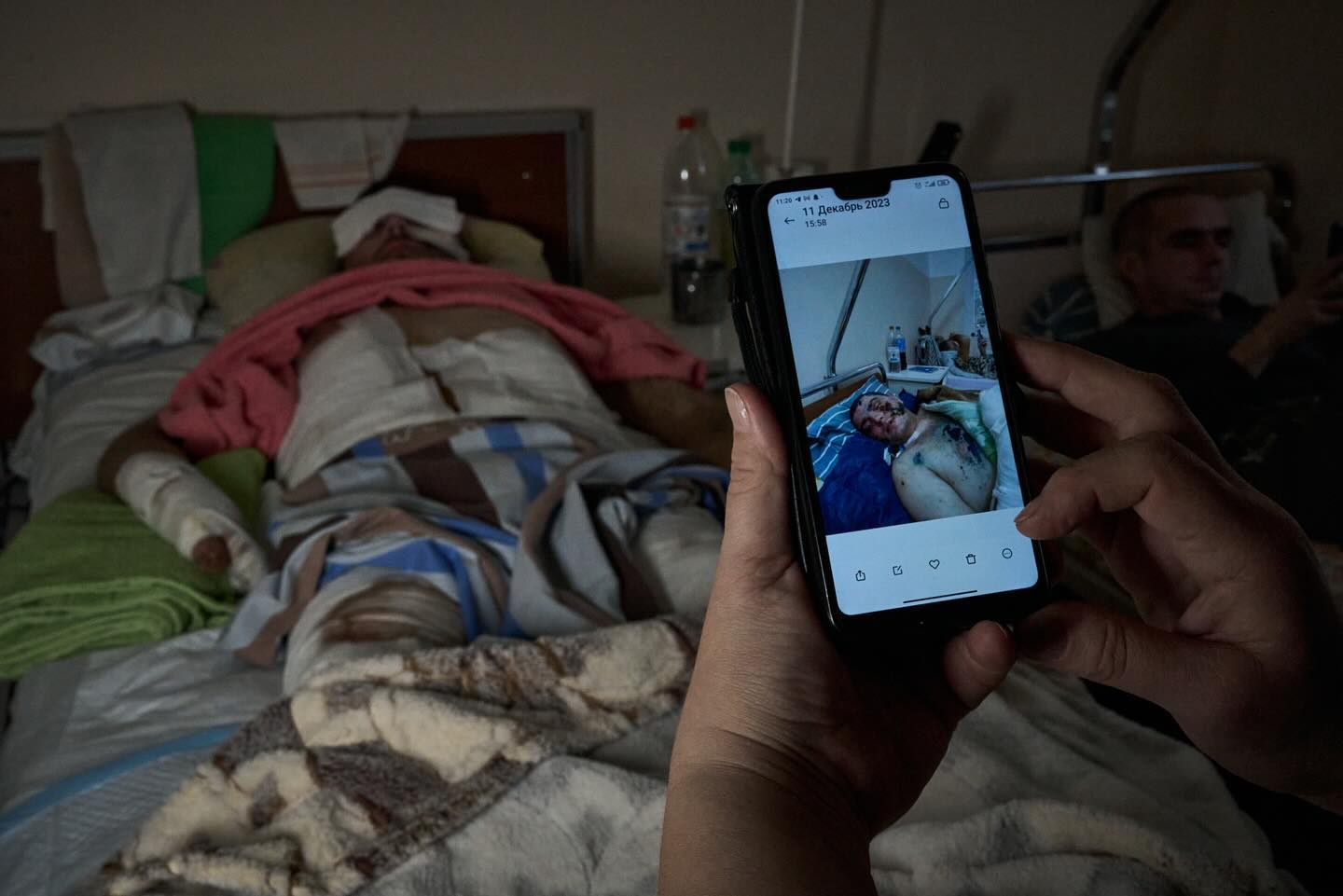 "У цих очах - все". Фотографи зворушили кадрами, як мама піклується про пораненого сина-воїна