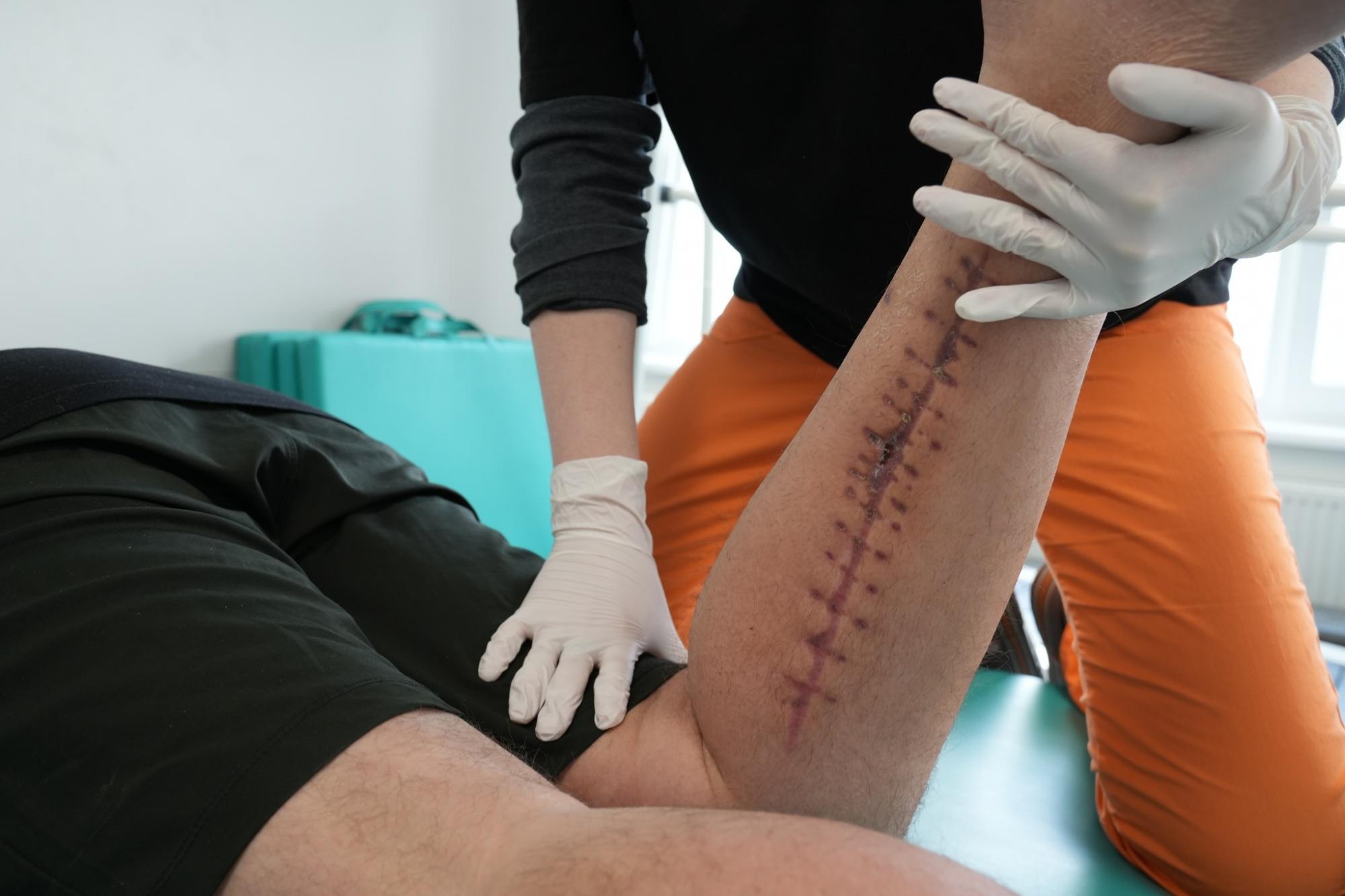 "Я витяг ікону та почав молитися". Поранений воїн вразив історією свого порятунку