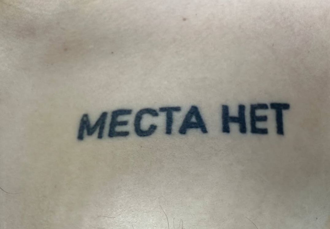 Снаряд вибухнув в 10 метрах від воїна. У Дніпрі врятували захисника з важким пораненням шиї