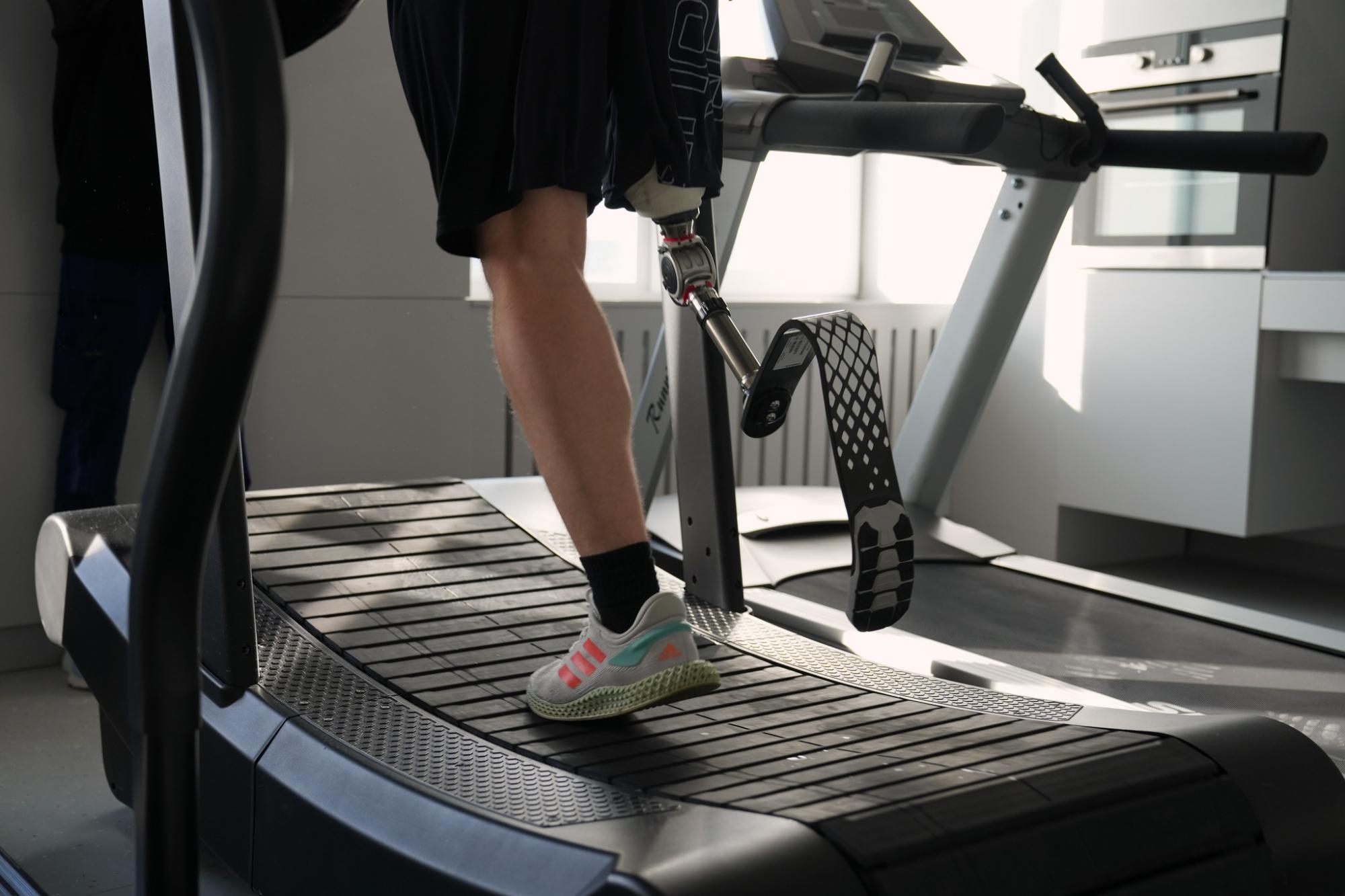 Зможе бігати на протезі. Львівські медики здійснили мрію пораненого воїна