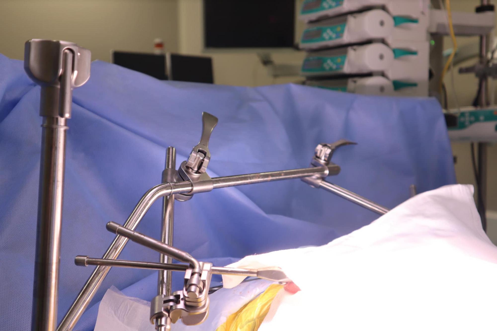 16 років не могли знайти причину болю: у Києві врятували дівчину з вродженою вадою