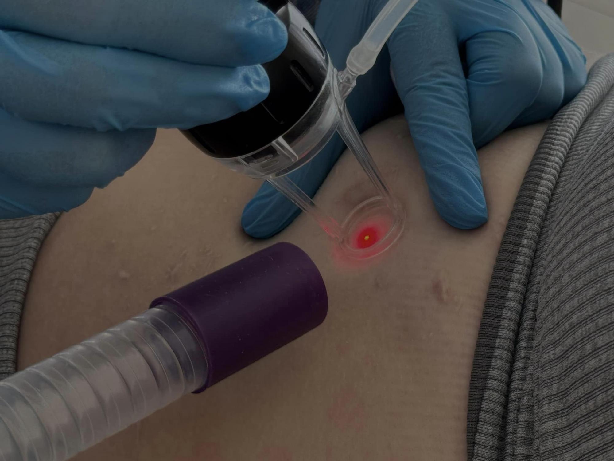 Ракета изувечила лицо: медики "возвращают красоту" 20-летней девушке перед свадьбой