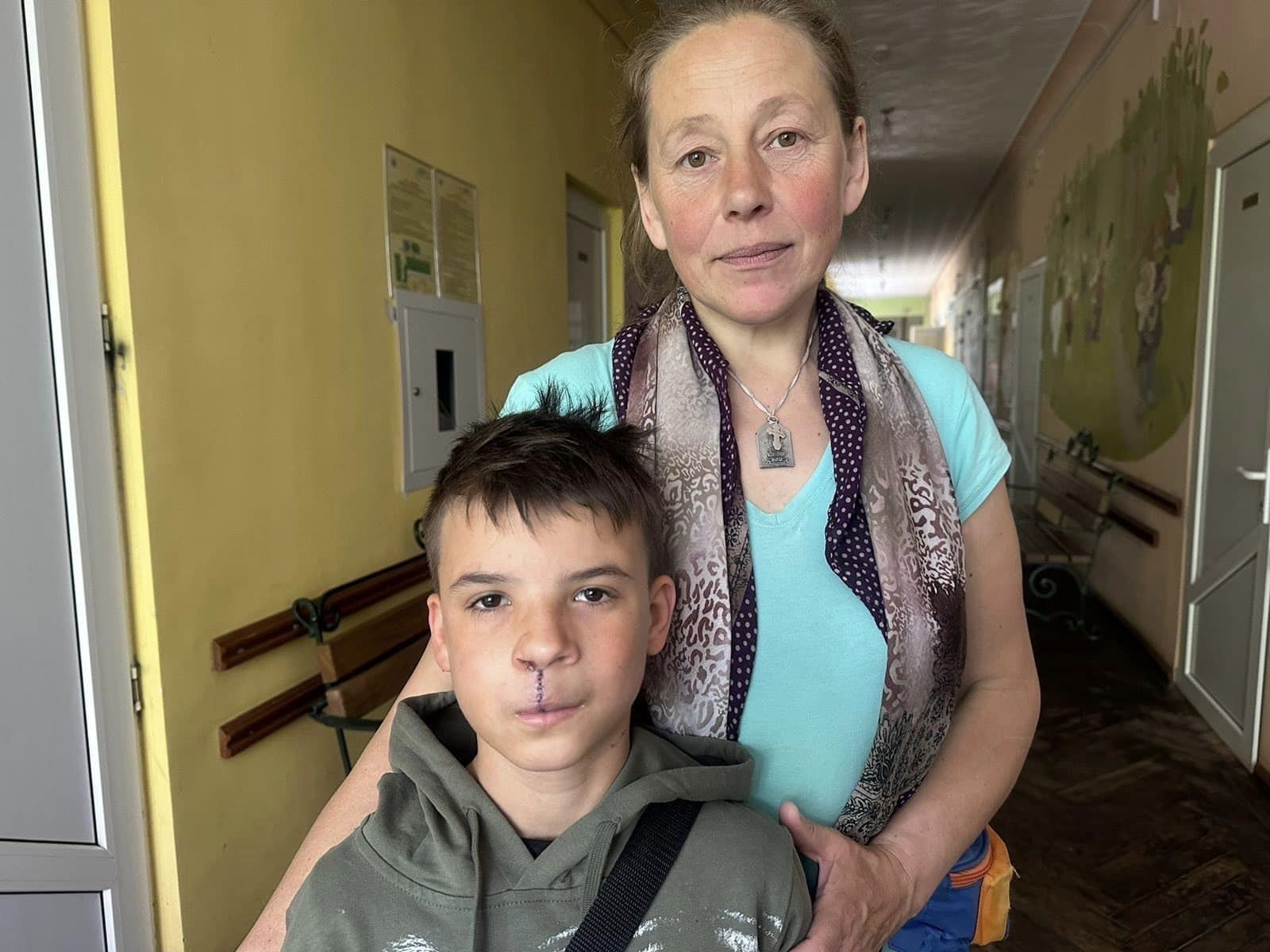 Називали кривоносим: у Львові хірурги з США зробили операцію сироті, яку він чекав все життя