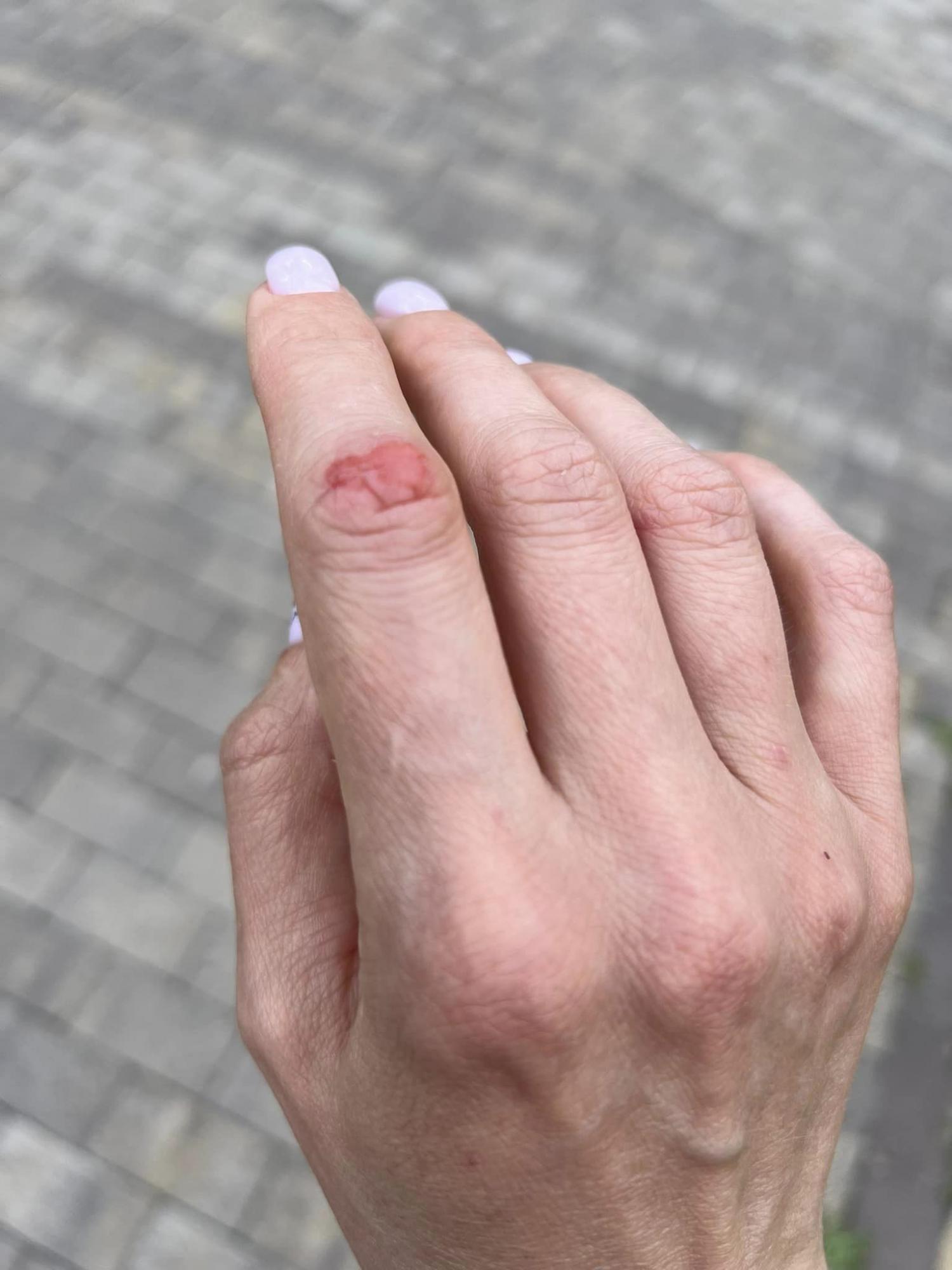 Лифт стал ужасной ловушкой для собаки: владельцам животных дали важный совет