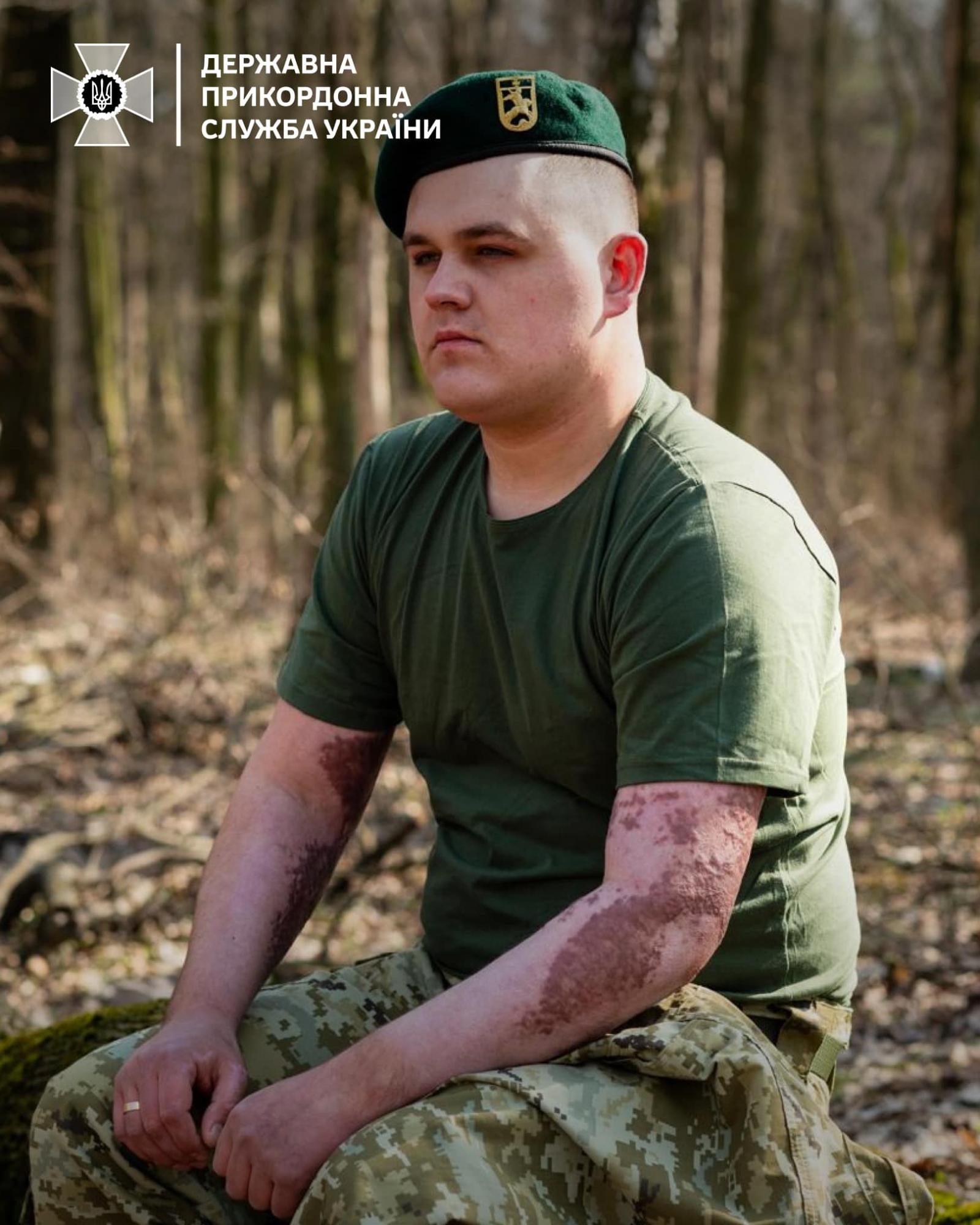 "Перемогти заради сина". Прикордонник з 70% опіків шкіри повернувся на службу
