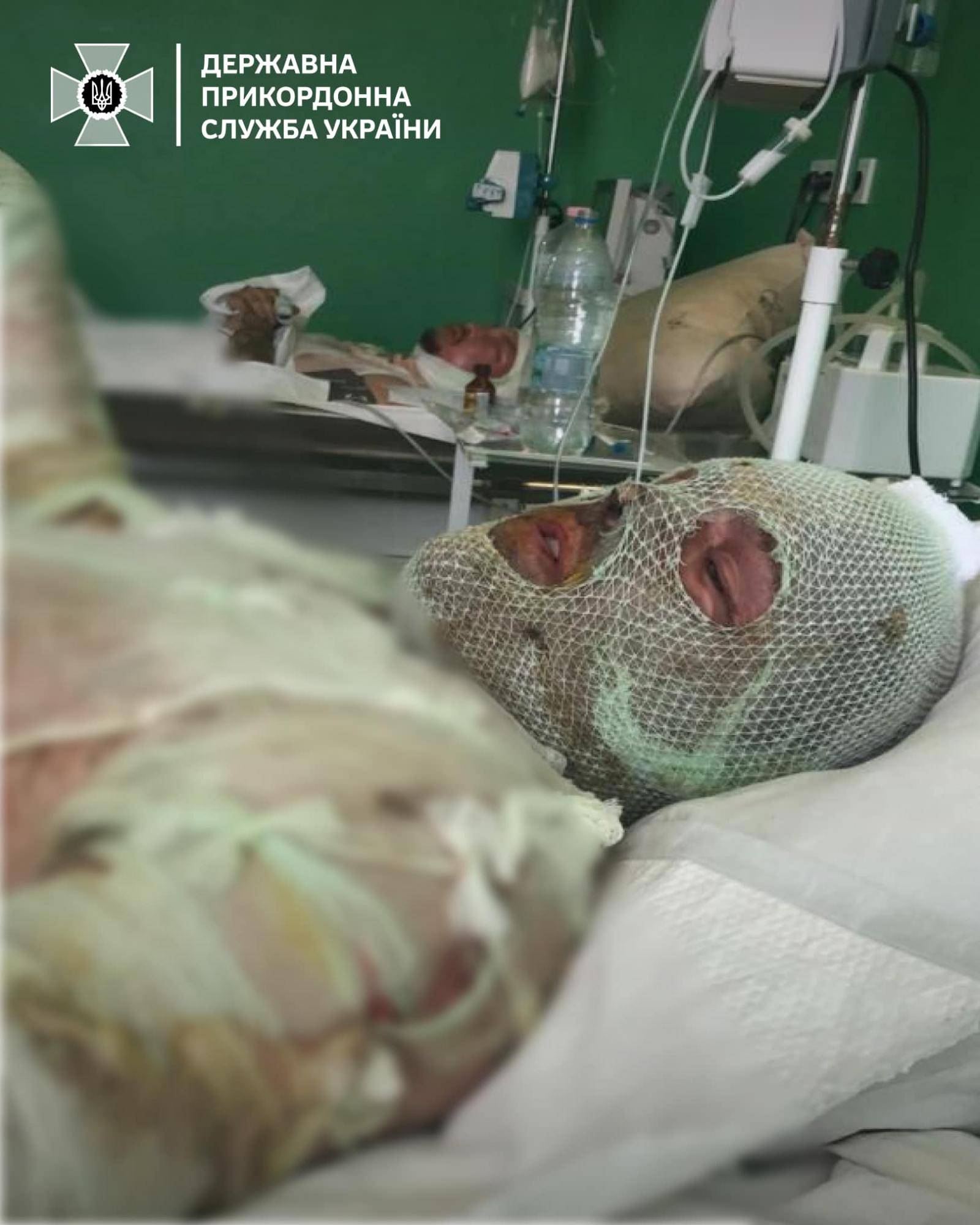 "Перемогти заради сина". Прикордонник з 70% опіків шкіри повернувся на службу