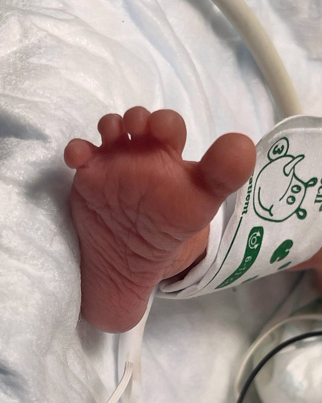 Звезда "Холостяка" оказалась в больнице: что известно