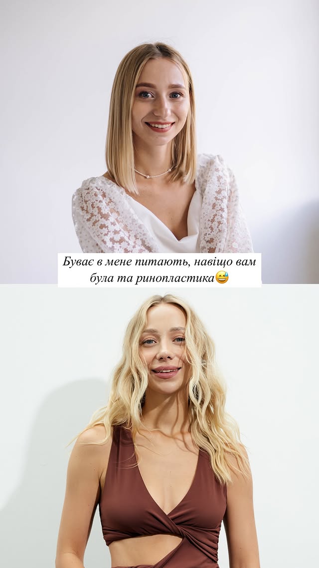 Дружина Віктора Павліка похизувалася новим обличчям після "пластики": як вона виглядає