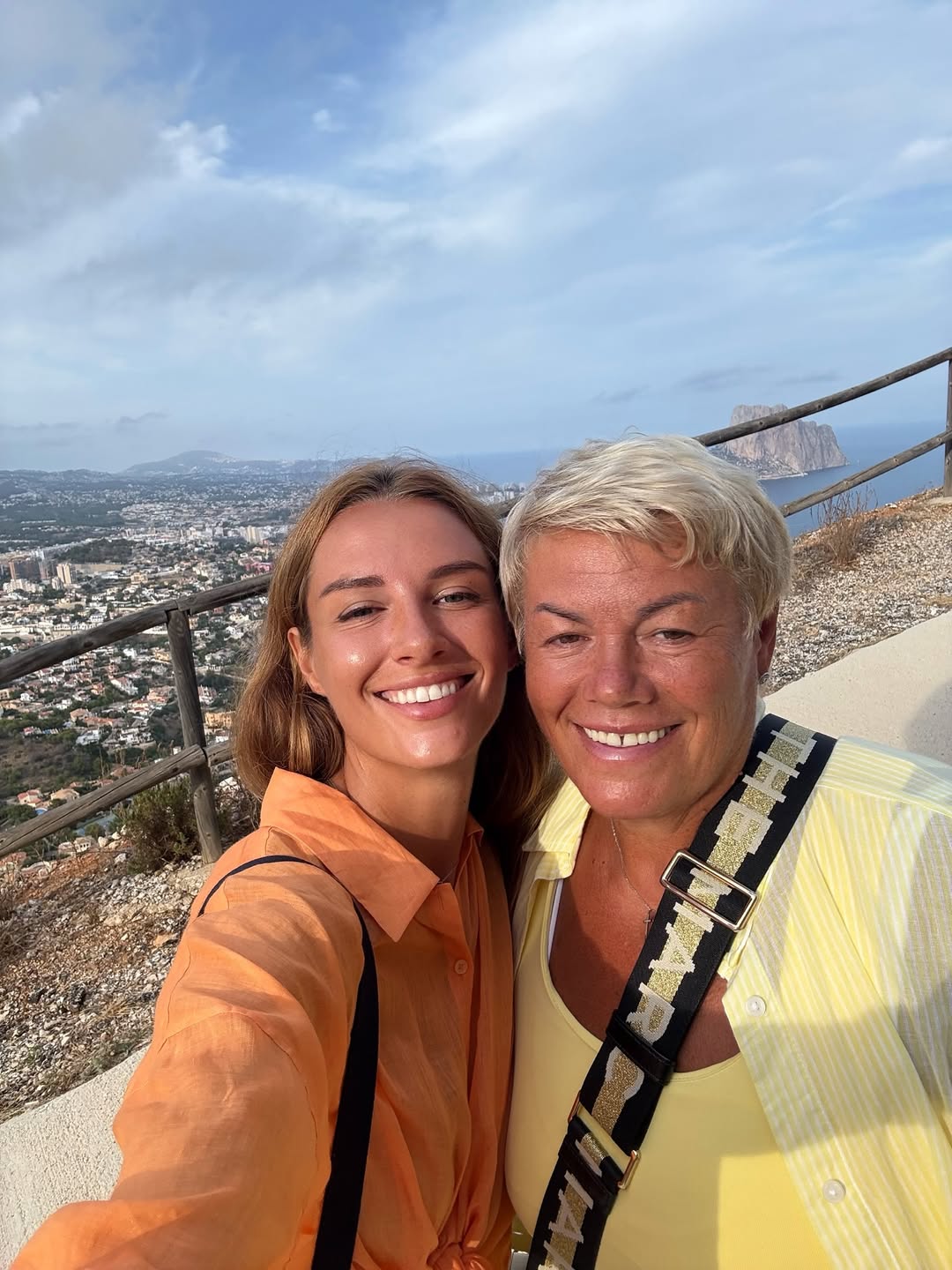 Модний лайфхак від дружини Решетніка: з чим носити довгі шорти