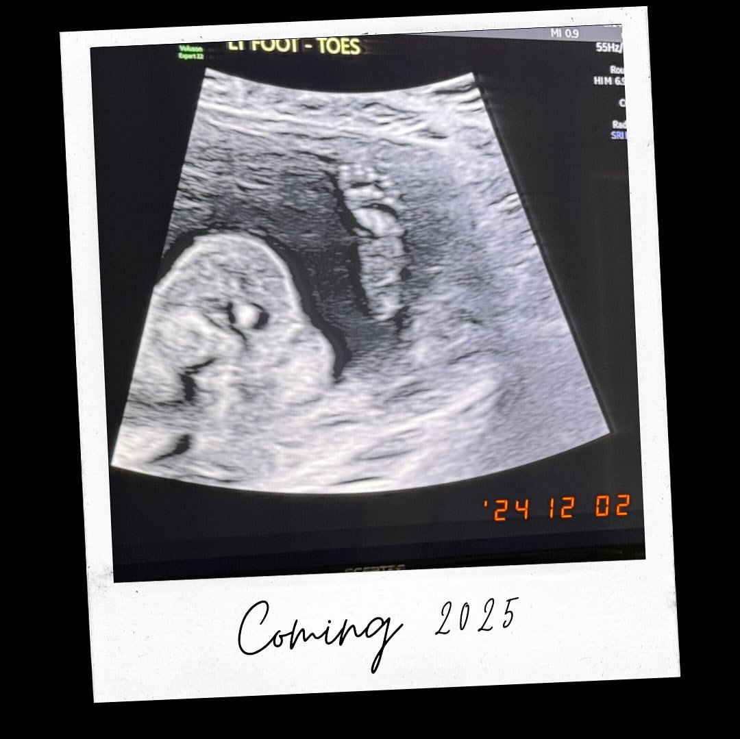 В платье трендового цвета: как выглядит младшая дочь Дональда Трампа, беременная первенцем