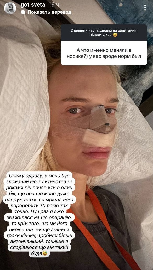 На тлі чуток про розрив: обраниця Цимбалюка зробила "пластику" та висловилася про актора