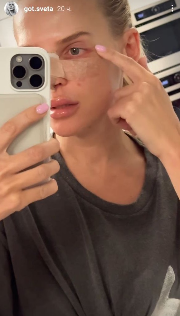 На тлі чуток про розрив: обраниця Цимбалюка зробила "пластику" та висловилася про актора