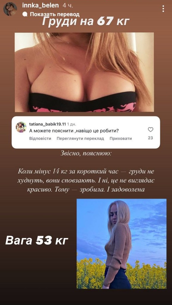 Інна Бєлєнь після "Холостяка" зробила "пластику" грудей і підборіддя