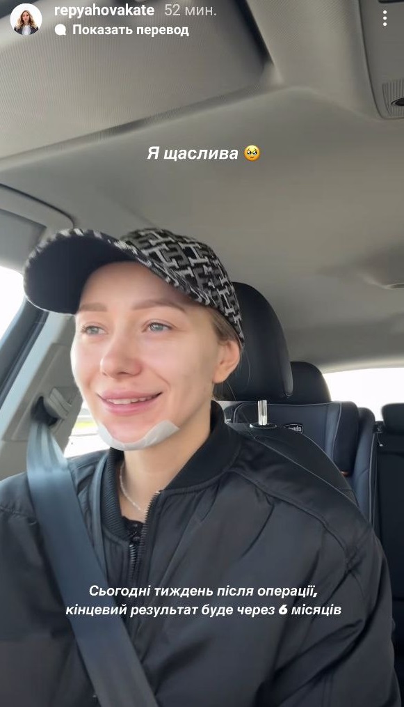 Дружина Віктора Павліка похизувалася новим обличчям після "пластики": як вона виглядає