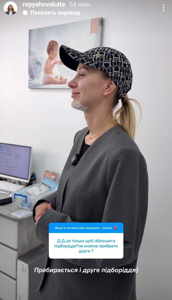 Дружина Віктора Павліка похизувалася новим обличчям після "пластики": як вона виглядає