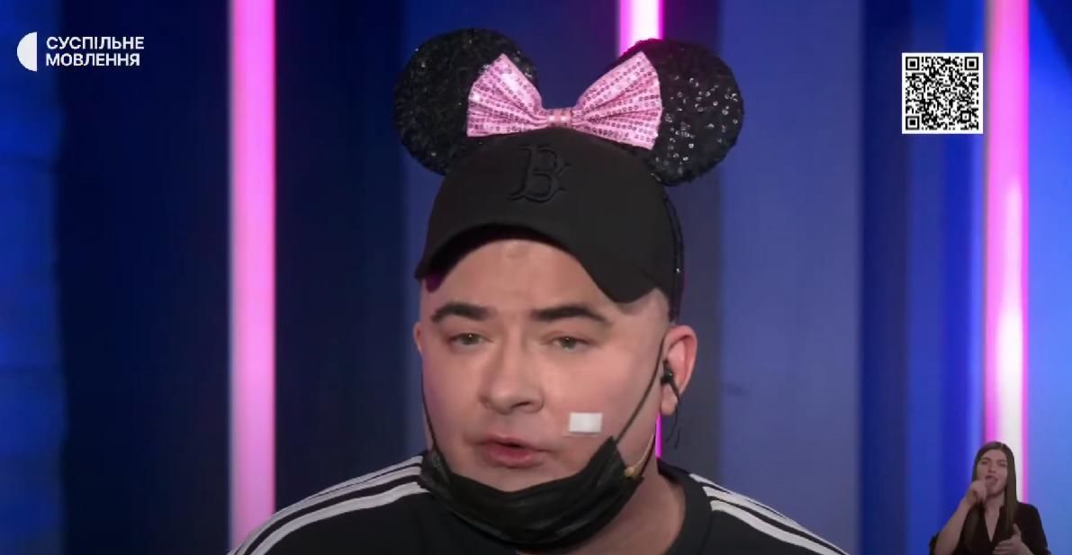 Андрей Данилко объяснил, почему сидел на Нацотборе с пластырем на щеке