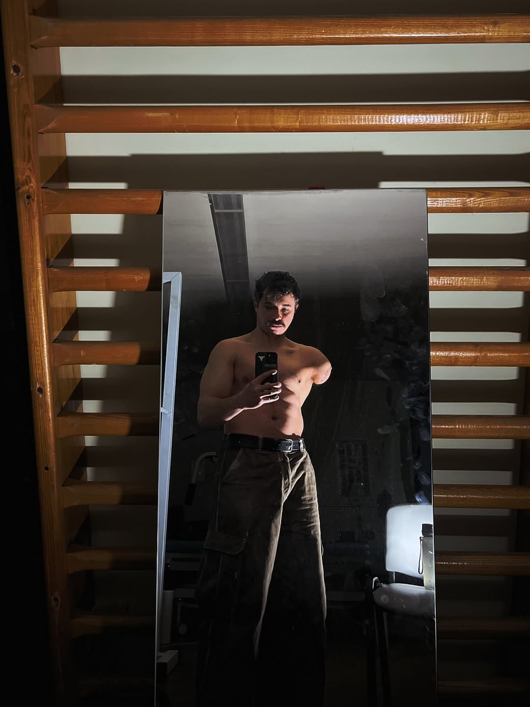 "Не лякайтесь": син Грубича показався з механічним протезом на руці (фото)