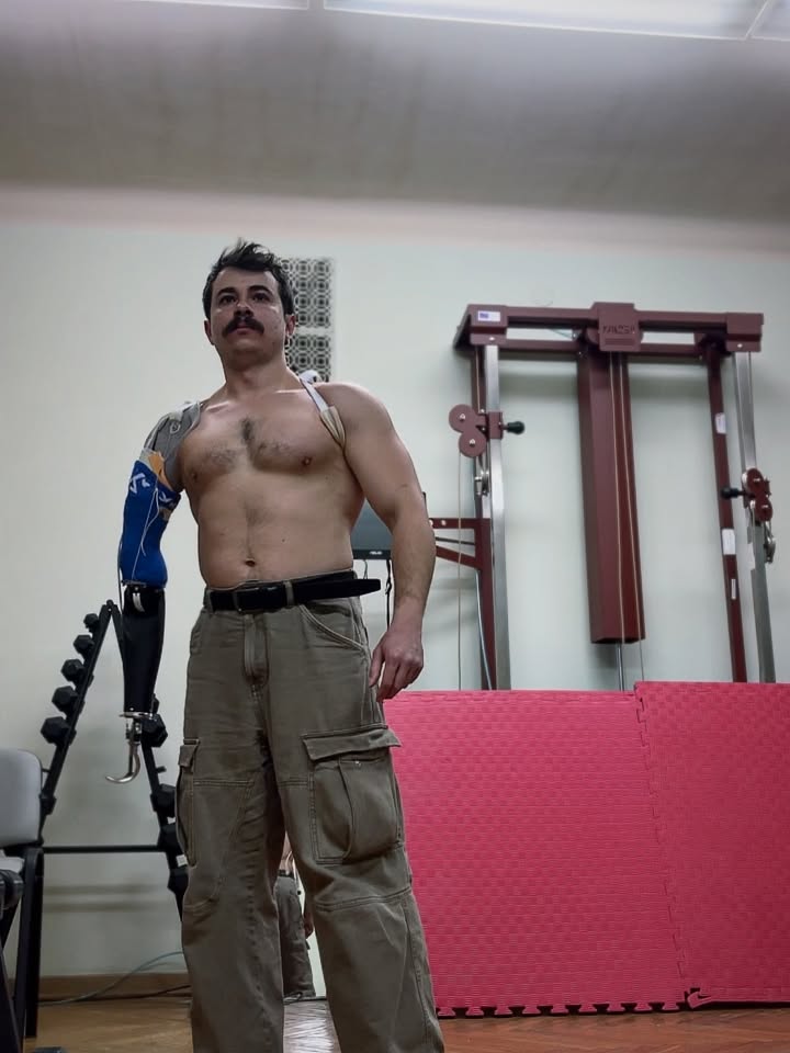 Уламки, контузії та важкі травми: українські зірки, які отримали поранення на фронті