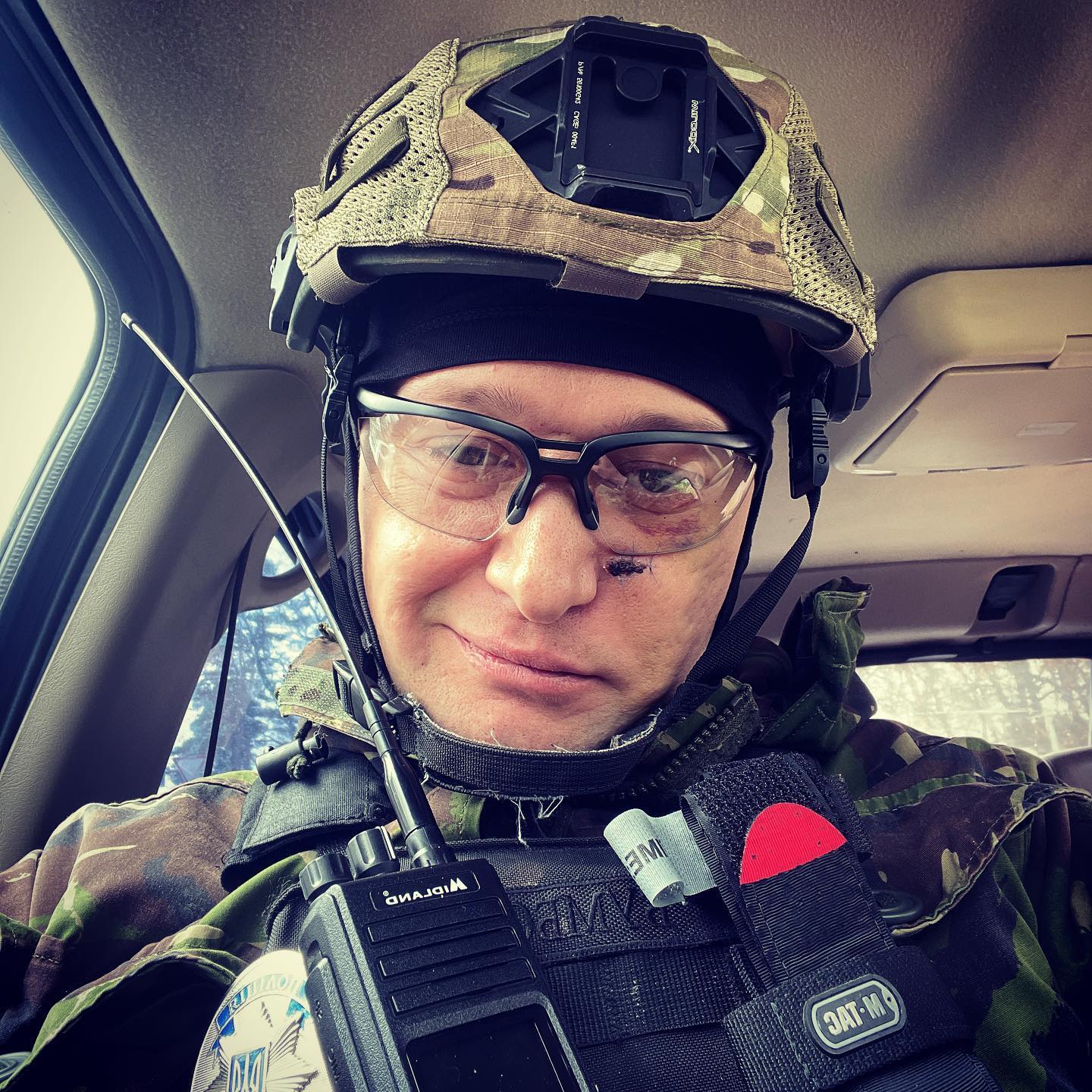 Уламки, контузії та важкі травми: українські зірки, які отримали поранення на фронті