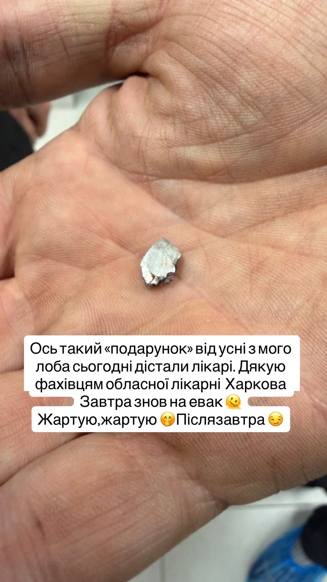 Ведучий і волонтер Христов потрапив під обстріл на Харківщині: з його лоба дістали уламок