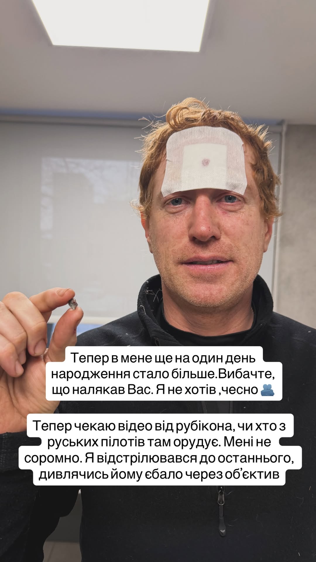 Ведучий і волонтер Христов потрапив під обстріл на Харківщині: з його лоба дістали уламок