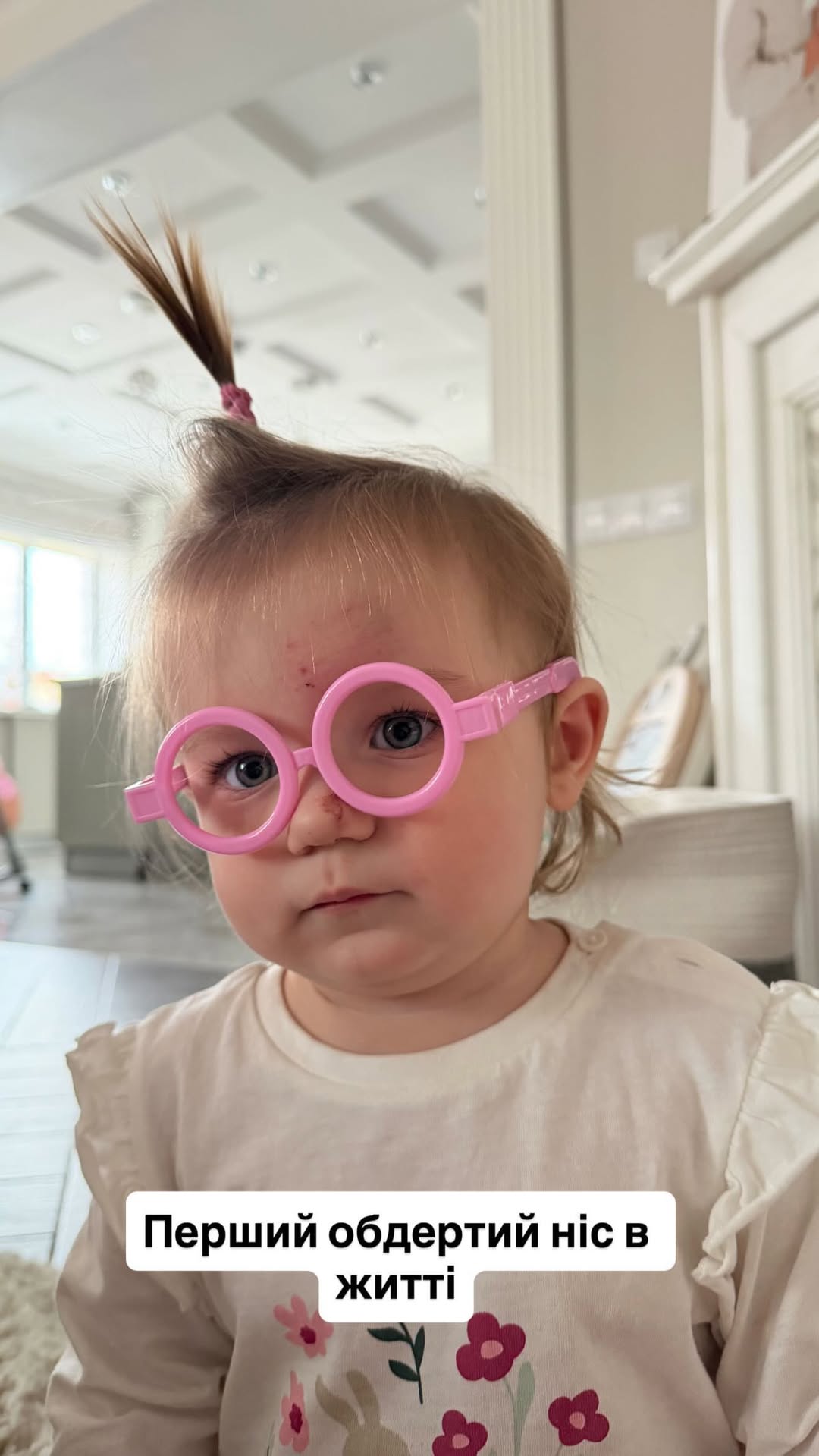 "Я ледь серце не вирвала": однорічна донька блогерки Верби серйозно травмувалася