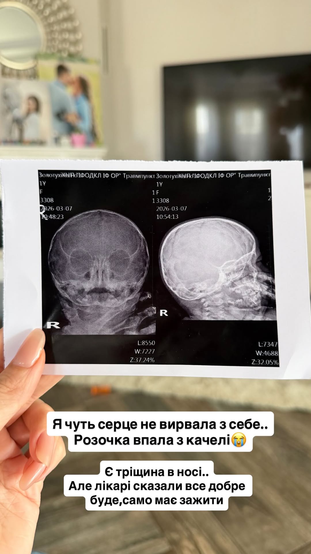 "Я ледь серце не вирвала": однорічна донька блогерки Верби серйозно травмувалася