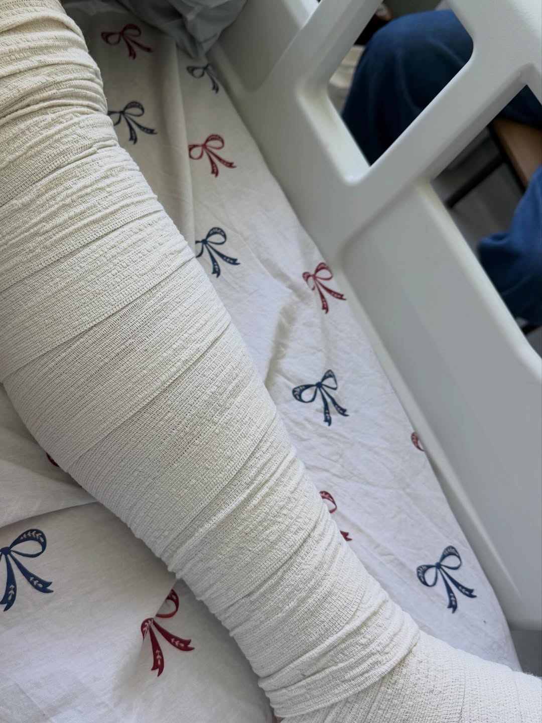 Юмористка Настя Ткаченко перенесла операцию по уменьшению желудка: что известно