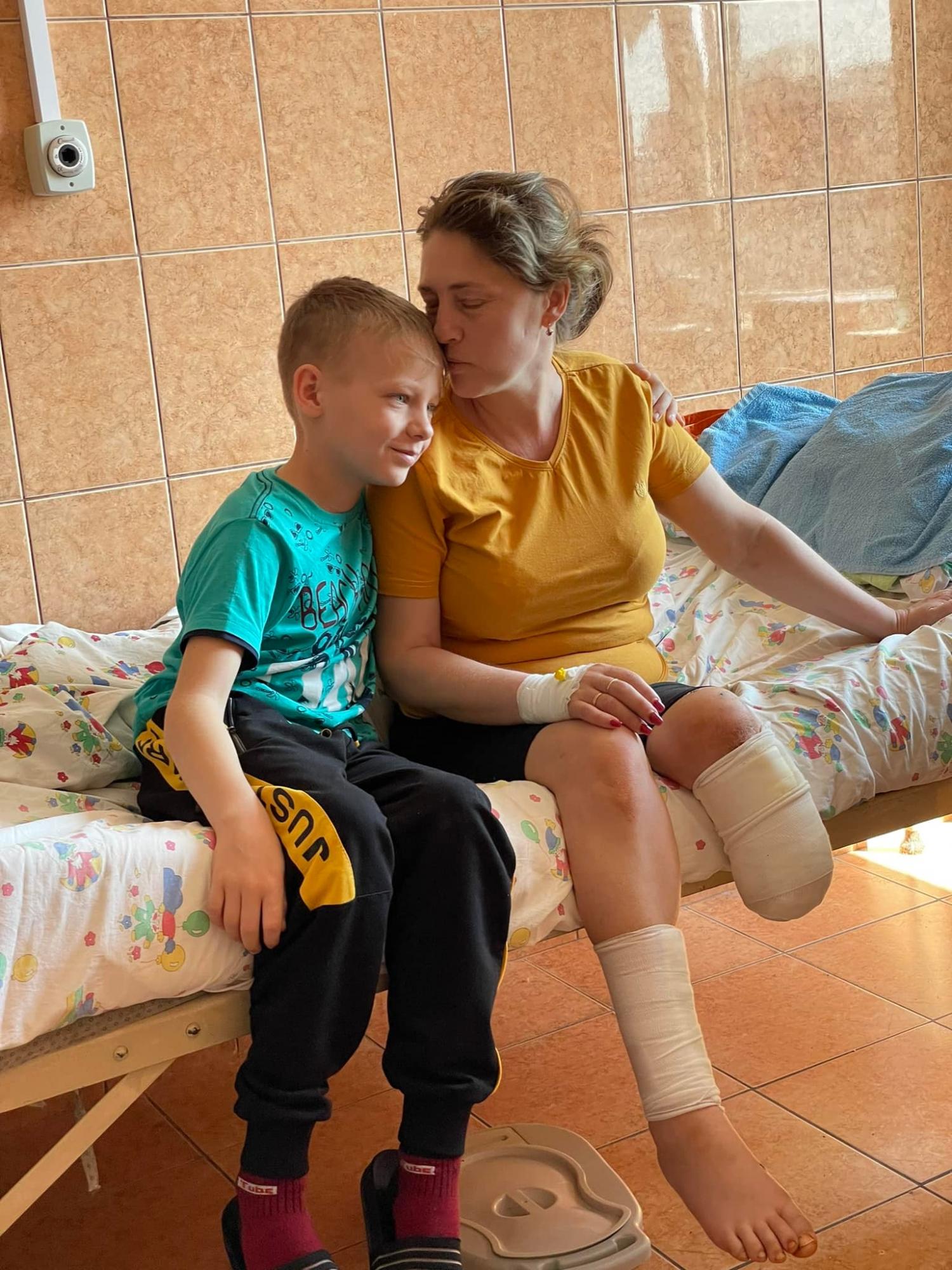 Мама й маленька донька втратили ноги на вокзалі Краматорська: історія та фото мужньої родини