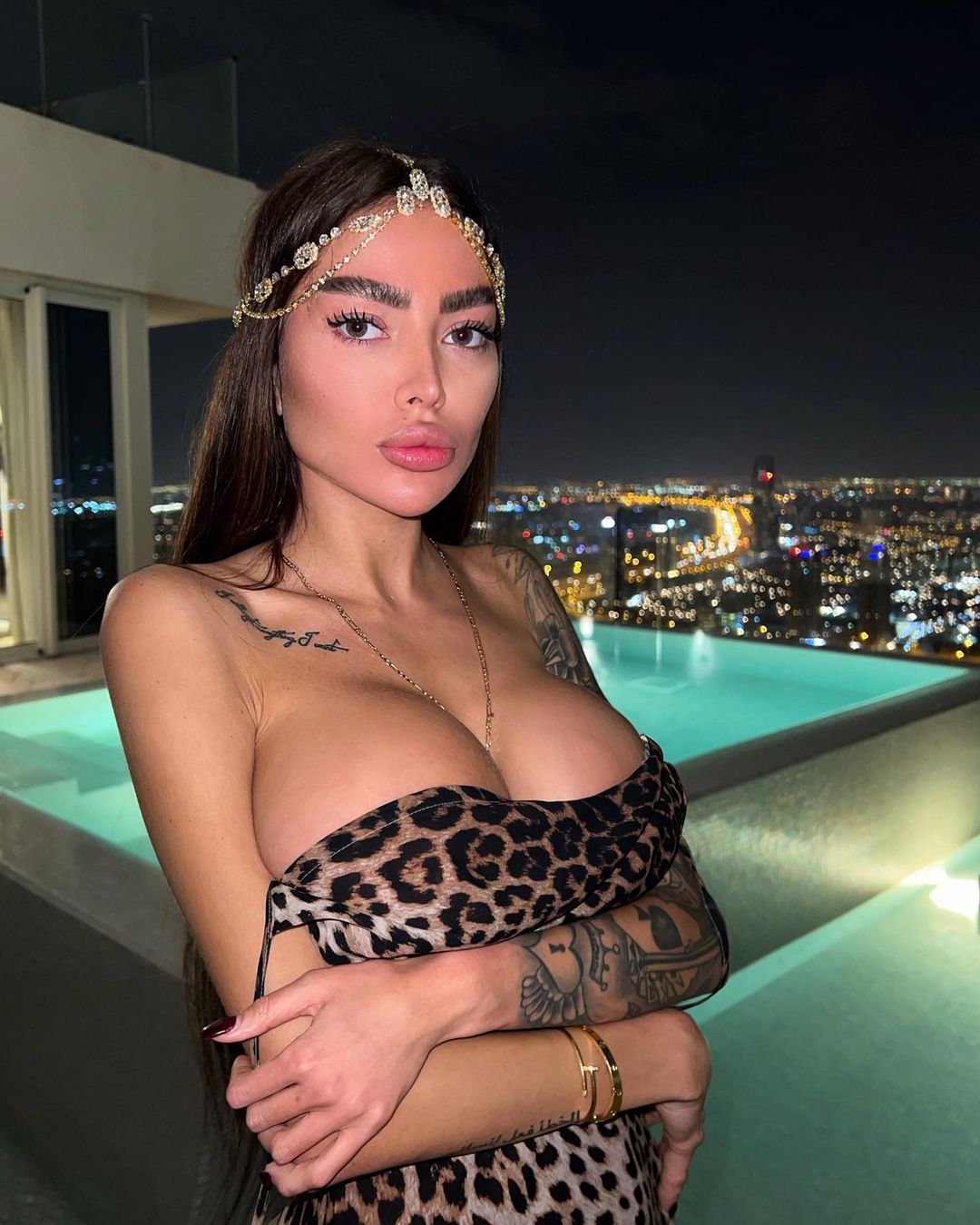 Погляньте, що сталося з "українською Кардаш'ян": знову лягла під ніж і тепер спокушає іноземців