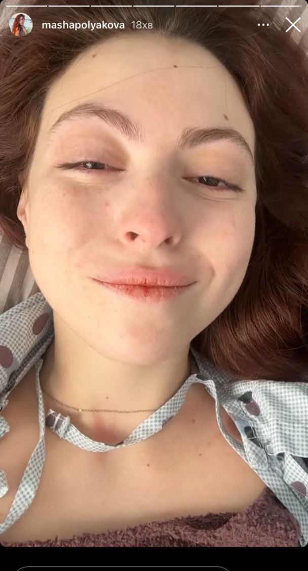 18-летняя дочь Оли Поляковой перенесла операцию