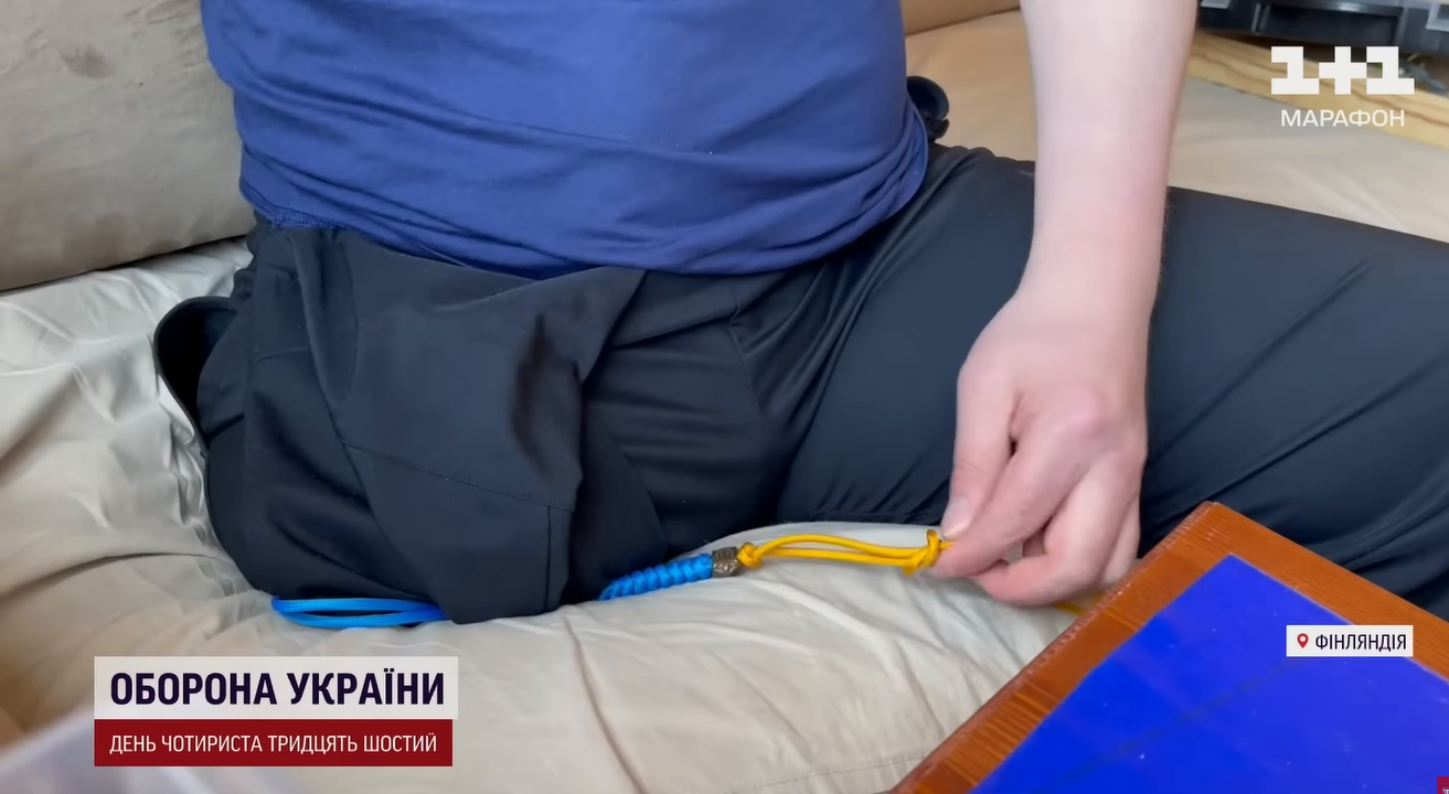 "Боялись, что рассыплется": врачи спасли бойца ВСУ с ожогами, для которых нет классификации