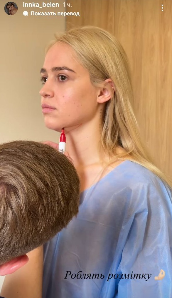 Інна Бєлєнь після "Холостяка" зробила "пластику" грудей і підборіддя