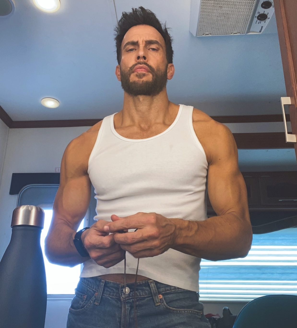 6 звезд, которые сделали пересадку волос