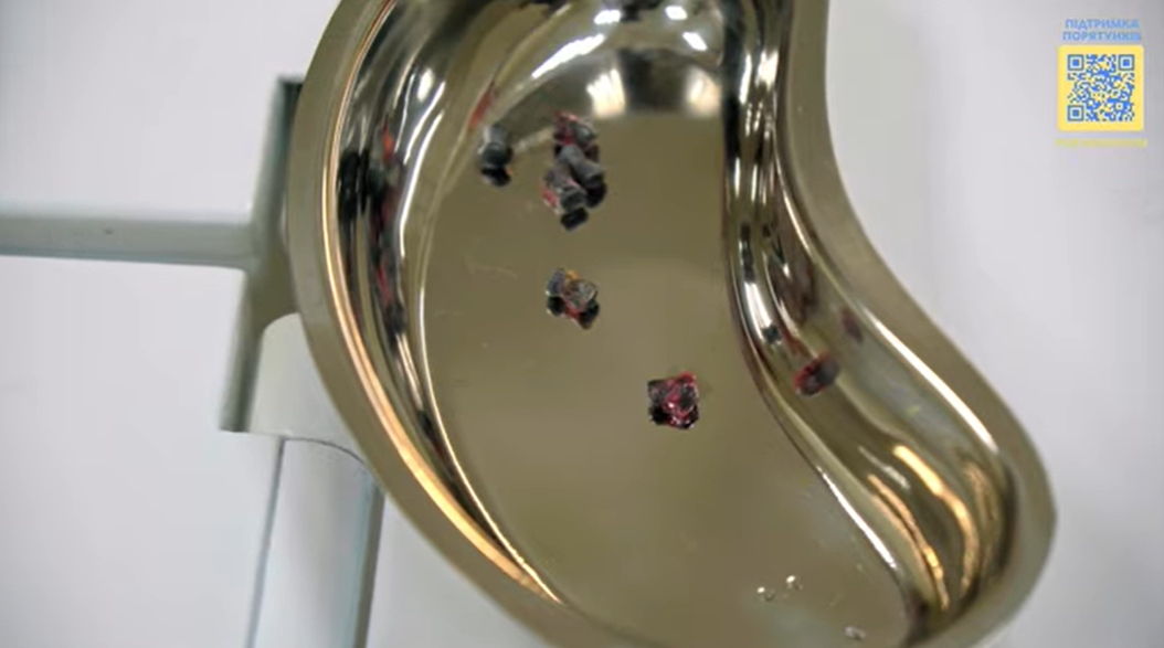 Под Киевом спасли раненого котика с 6 пулевыми: история пушистика не оставит вас равнодушными