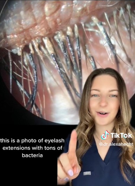 Окулист показала видео, после которого вам больше не захочется наращивать ресницы