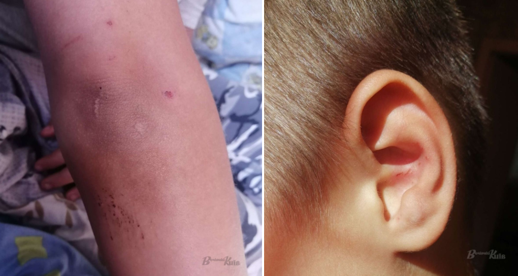 У Києві школяр звинуватив вчителя в побитті: що тепер загрожує педагогу