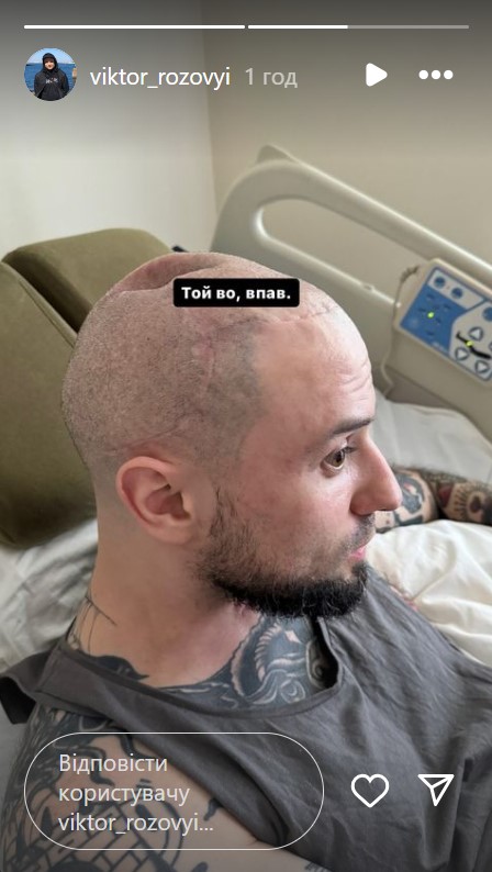 Зірка "Ліги сміху" Розовий вперше показав наслідки важкого поранення (фото)