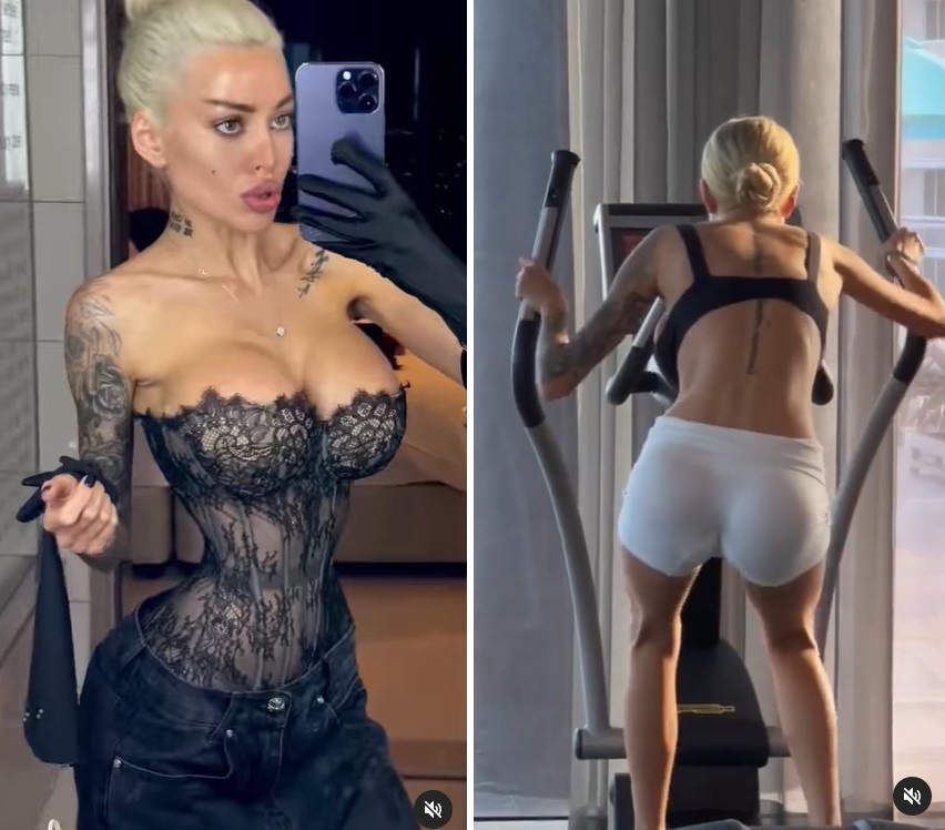 Погляньте, що сталося з "українською Кардаш'ян": знову лягла під ніж і тепер спокушає іноземців